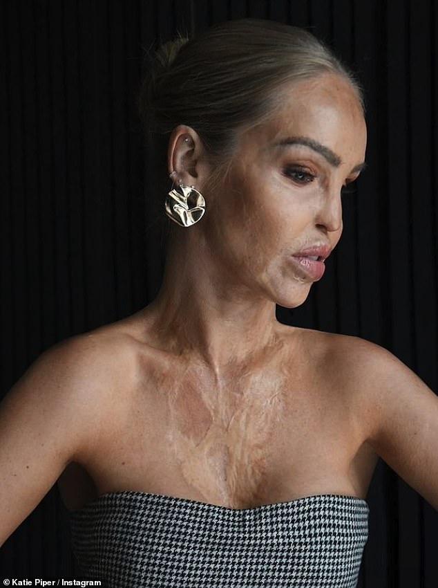 Katie Piper répond au troll sur Instagram