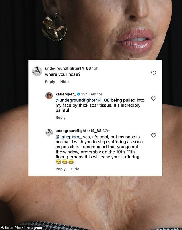 Katie Piper partage le commentaire cruel