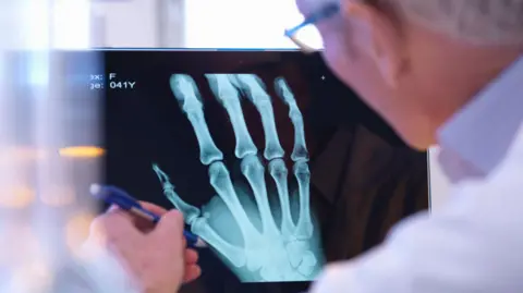 Médecin regardant une radiographie de la main d'une personne