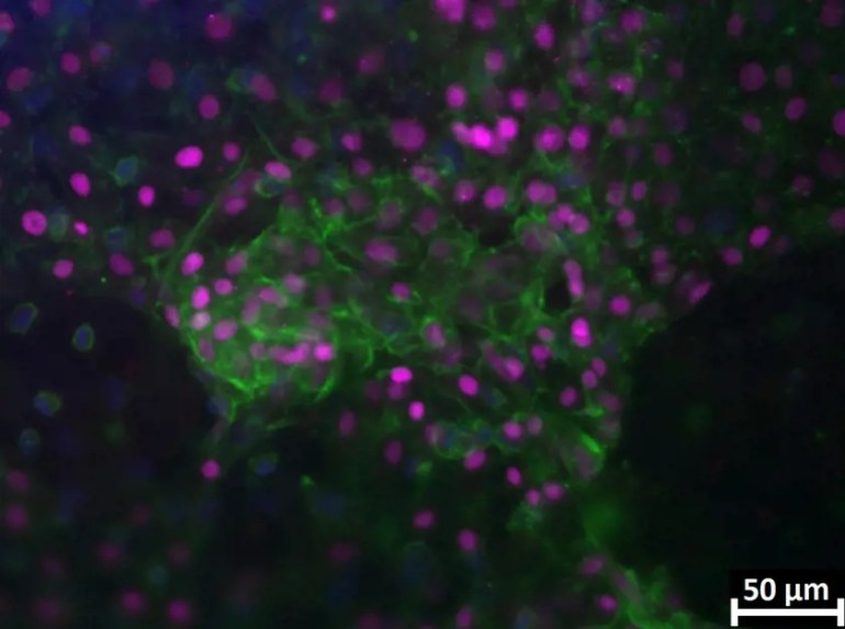 Les cellules souches largement utilisées dans l'ingénierie des tissus.