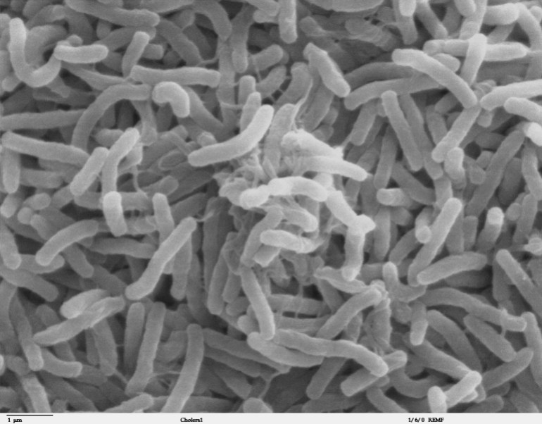 Bactéries de choléra au microscope électronique