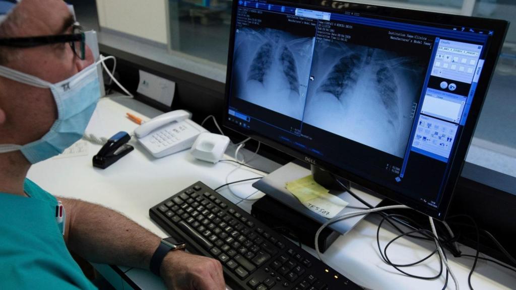Un sanitaire observe des images d'un cancer du poumon.