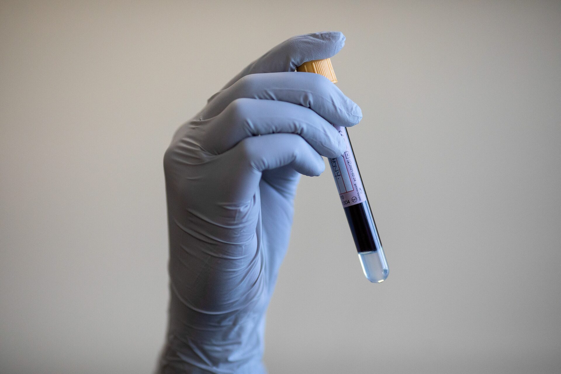 Experts estiment qu'un déploiement national du dépistage universel du cancer est possible d'ici moins de dix ans