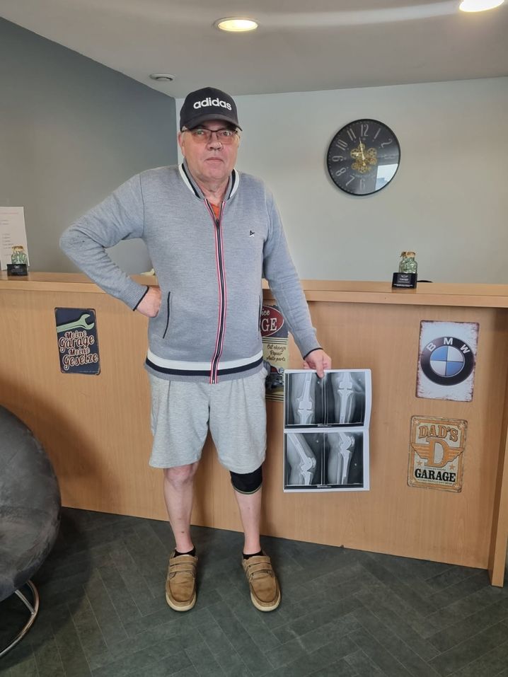 Après un an et demi de combat, Fabrice Robin a fait plier l'entreprise Stryker. Elle va fabriquer les pièces à changer sur sa prothèse qu'il porte depuis ses vingt ans. Sans ça, il risquait l'amputation de sa jambe.