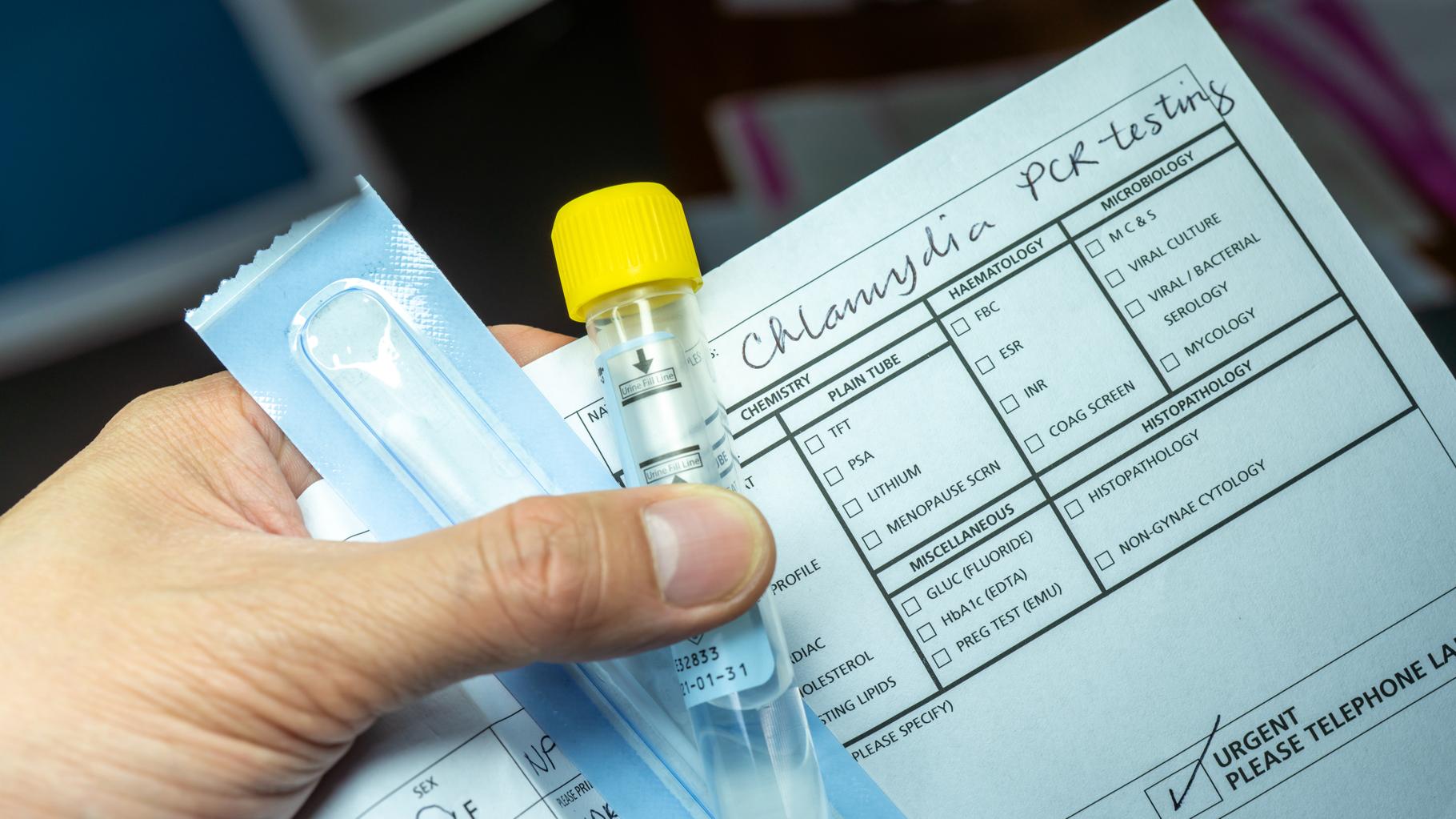 Kit de dépistage à domicile pour les IST