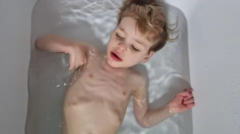 Ivan allongé dans un bain montrant une perte de poids