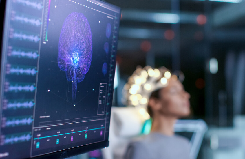 Implant cérébral capable de lire les pensées et de les transformer en parole