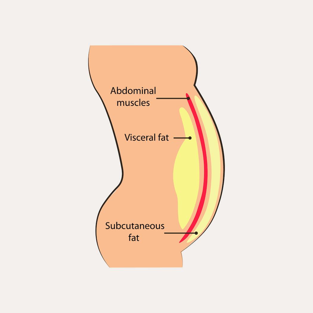 Coupe transversale de l'abdomen montrant muscles, graisse viscérale et graisse sous-cutanée.